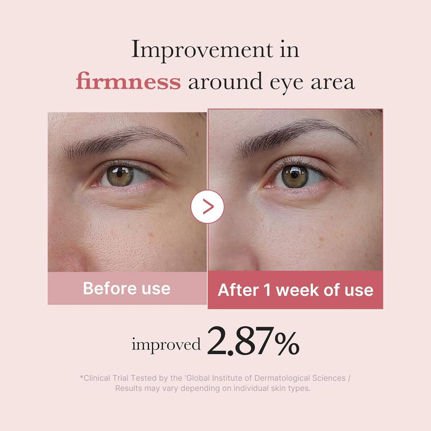 MEDICUBE Sérum pour les yeux au peptide rose et ADN de saumon PDRN 30 ml