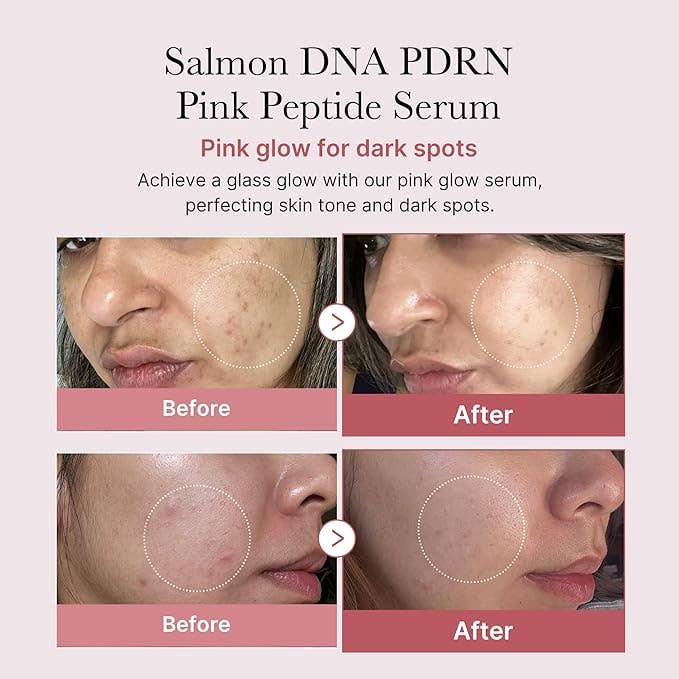 MEDICUBE Sérum Peptide Rose ADN de Saumon PDRN 30ml 1.01 fl.oz.