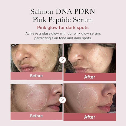 MEDICUBE Sérum Peptide Rose ADN de Saumon PDRN 30ml 1.01 fl.oz.